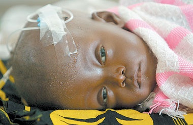 علماء يرصدون جينات يمكن أن تقي أطفال افريقيا من الاصابة بالملاريا