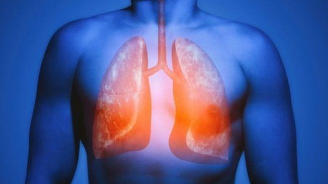 دراسة: الرئة تصلح نفسها بعد ترك التدخين