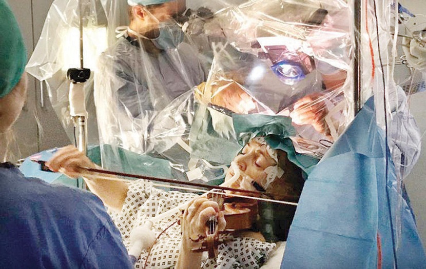 مريضة تعزف على الكمان أثناء عملية جراحية