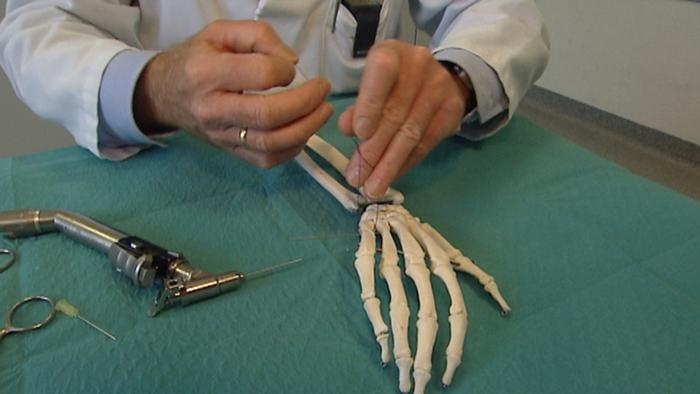 باستخدام الطباعة المجسمة .. تقنية جديدة لصناعة العظام 