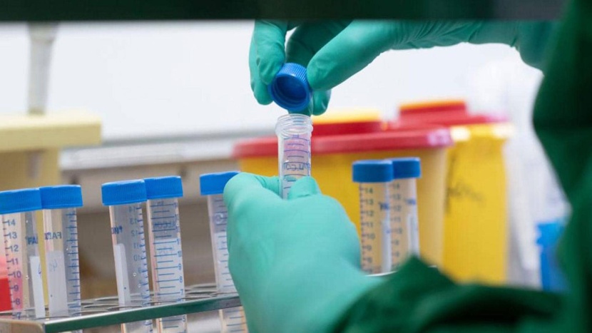 تأكيدات حول إمكانية تصدير عقار رمديسيفير خارج الولايات المتحدة