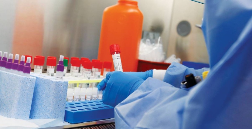 سلالة «جي 4» من إنفلونزا الخنازير ليست جديدة ولا تصيب البشر