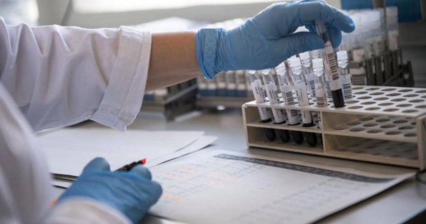 تراجع في الأجسام المضادة لمتعافي كورونا