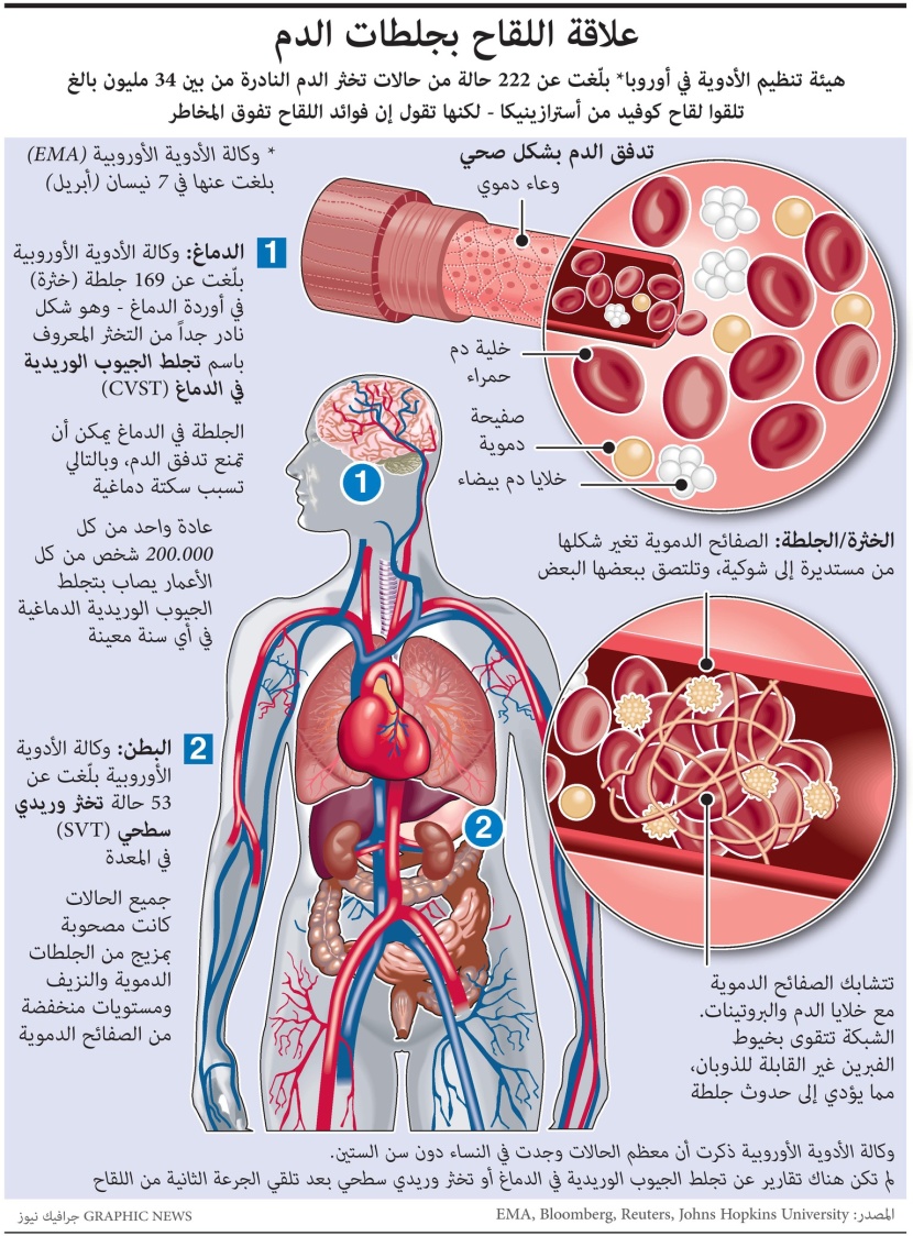 ماهي علاقة لقاح أسترازينيكا بجلطات الدم