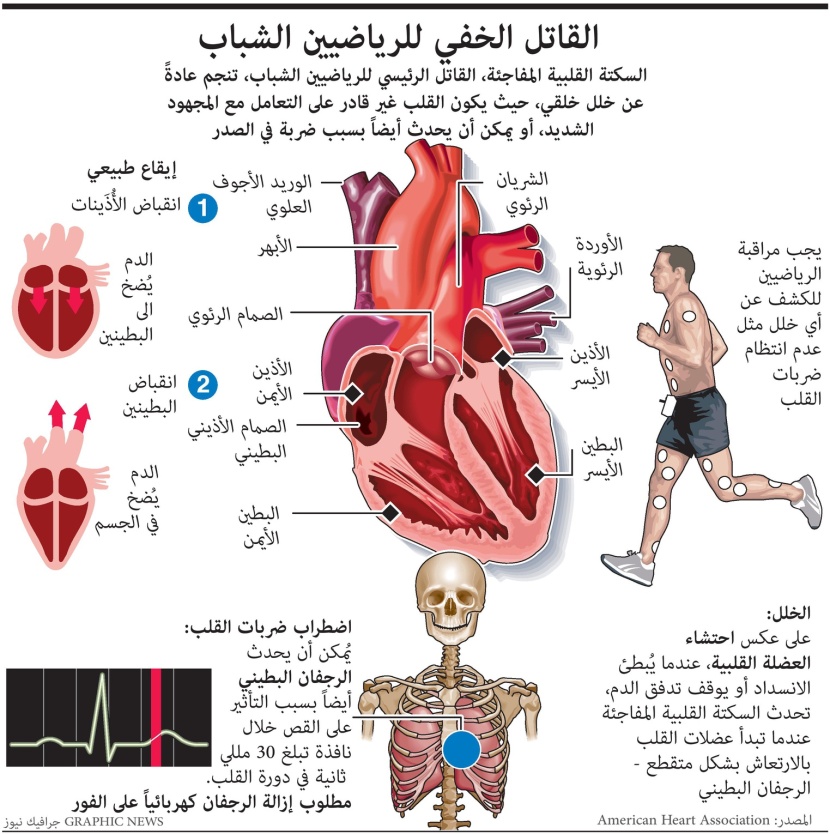 ماهو القاتل الخفي للرياضيين الشباب؟