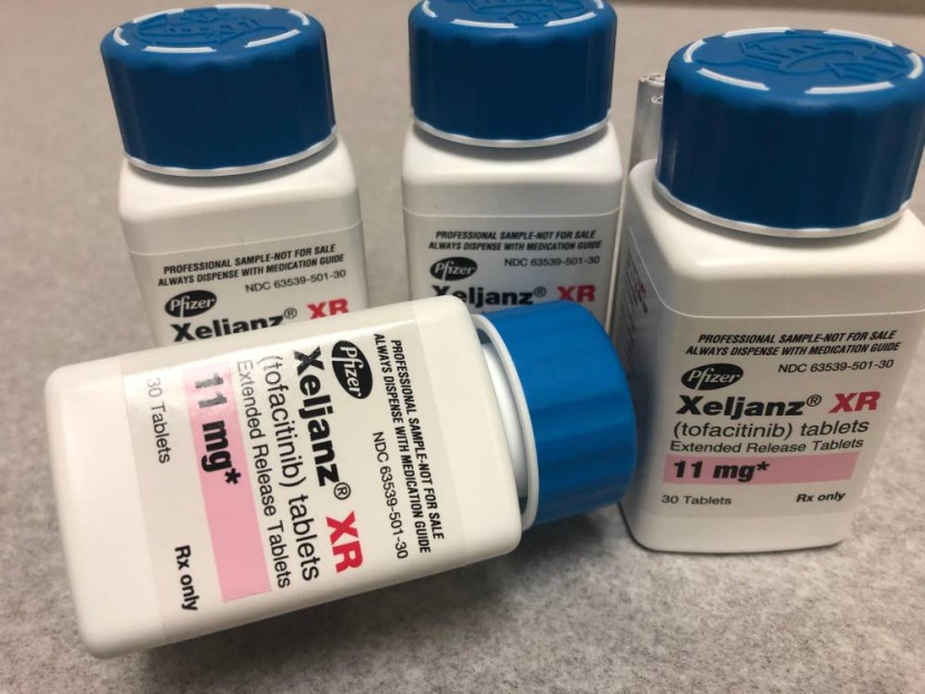 دواء لالتهاب المفاصل يعطي نتائج واعدة في معالجة كوفيد