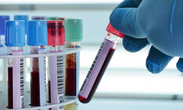 فحص دماء سكان ووهان لتتبع أصل كورونا