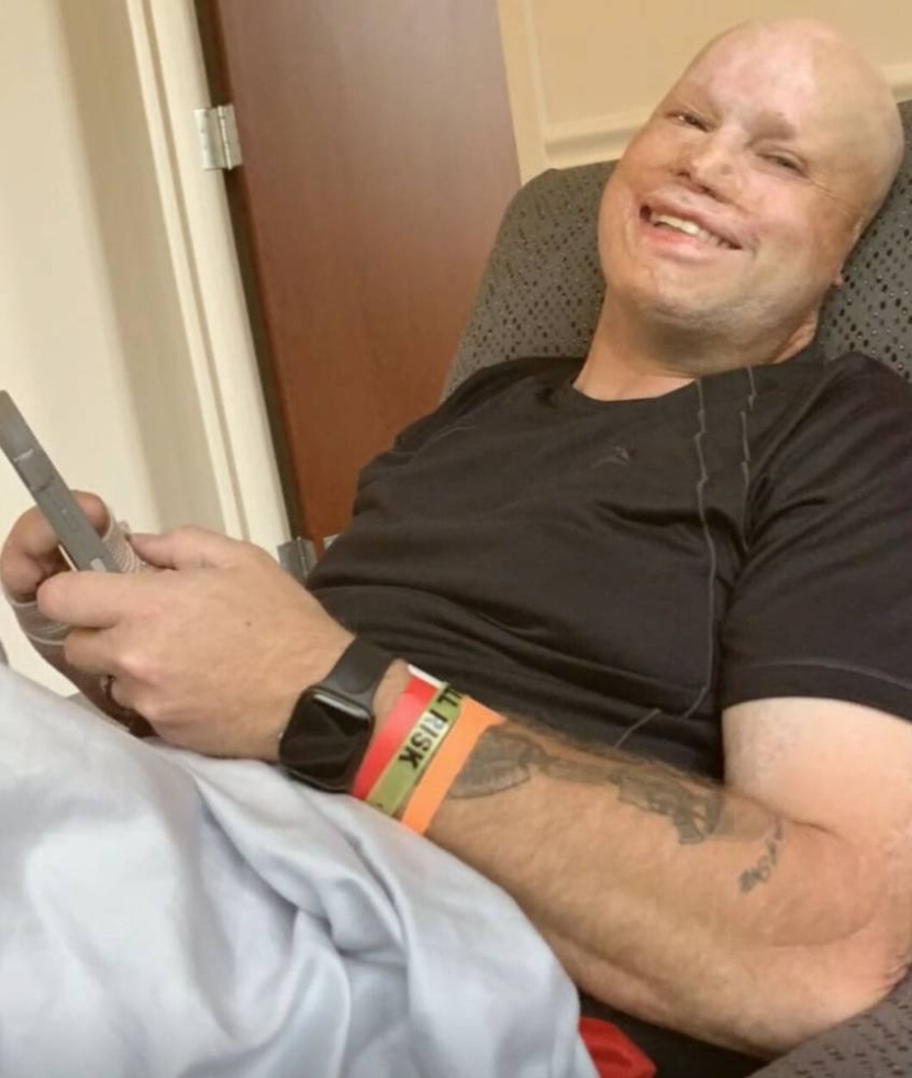 عملية جراحية رائدة تضيق الفجوة بين الإنسان والآلة