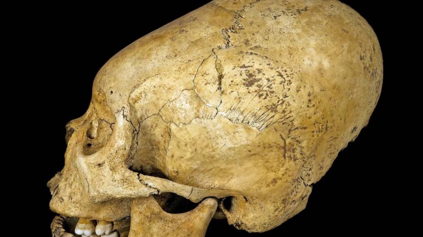 اكتشاف جمجمة بشرية تحتوي على مادة غريبة