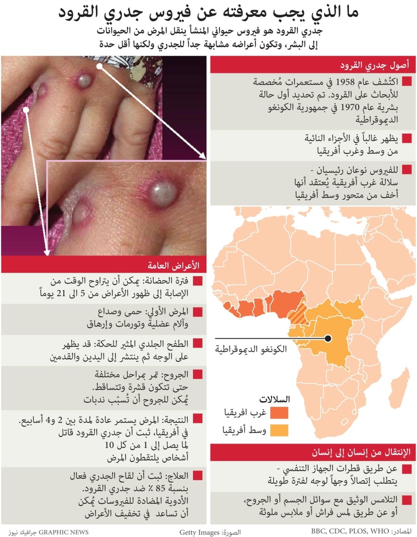 ما الذي يجب معرفته عن فيروس جدري القرود ؟