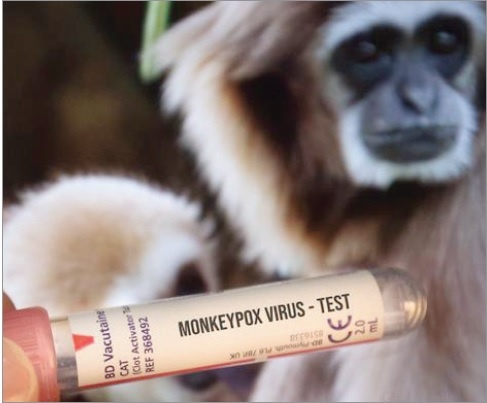 أمريكا .. اللقاحات تكافح «جدري القرود»