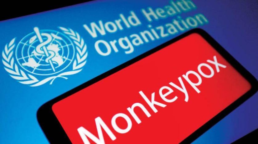 «جدري القرود» .. 14 ألف إصابة حول العالم