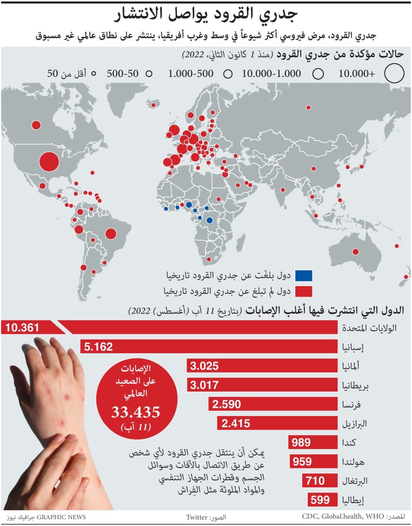 جدري القرود ينتشر في عدة دول والولايات المتحدة تتصدر الإصابات