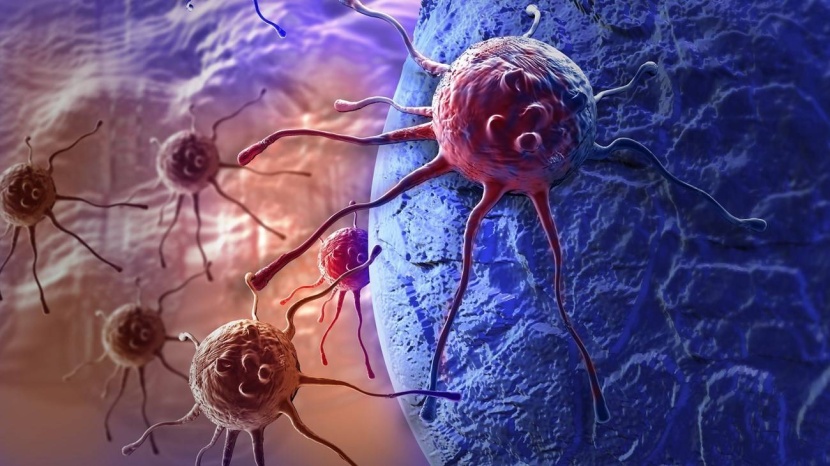 رقاقة إلكترونية لقياس معدل انتشار السرطان في الجسم