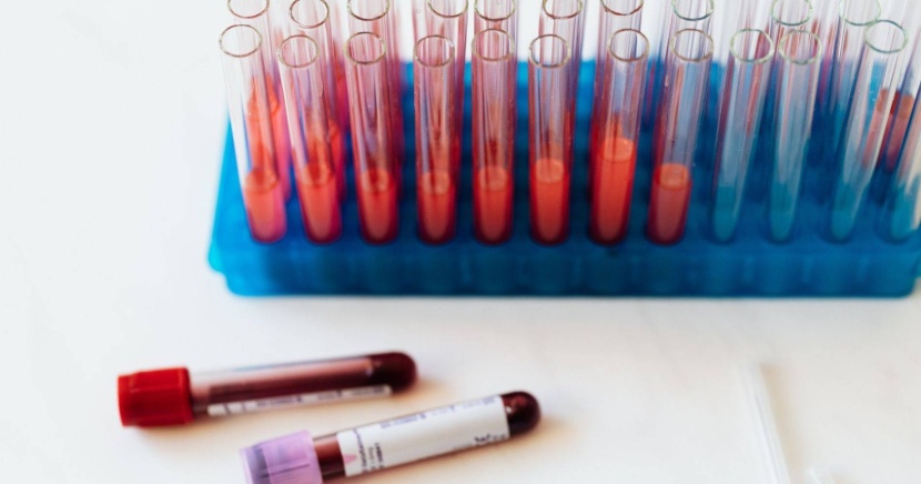 فحص سريع يكشف أمراض السرطان والقلب خلال يوم