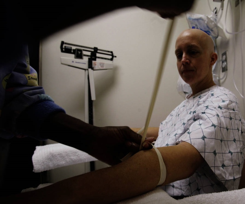 بروتوكول يجعل العلاج الكيميائي للسرطان أكثر بساطة