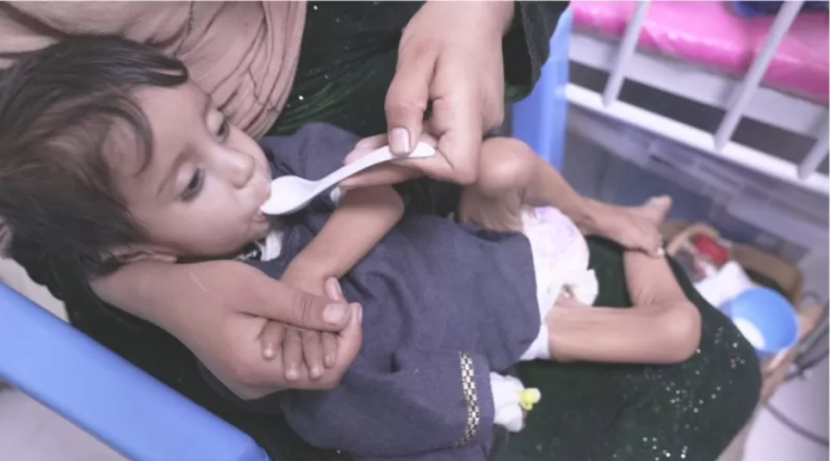 في أفغانستان .. أسر تبيع بناتها وأم تبيع كليتها لسد رمق أطفالها