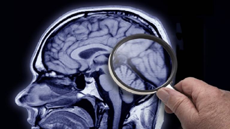 الخبراء يضعون قائمة من 12 خطوة لتقليل مخاطر الخرف