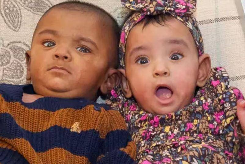 توأم بحجم كف اليد يدخل موسوعة جينيس