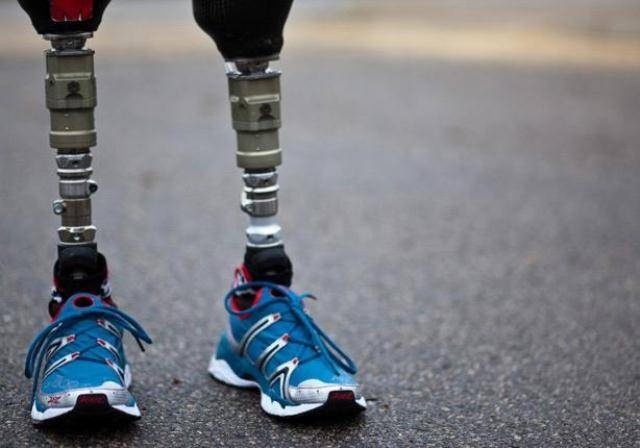 كينيان يحولان النفايات إلى أطراف صناعية آلية